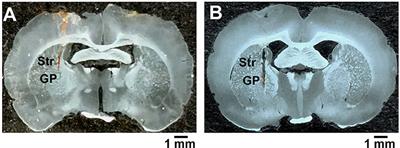 Adenosine A2A Receptor Modulates the Activity of Globus Pallidus Neurons in Rats